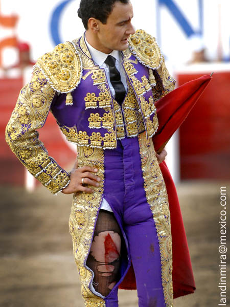 Impresionante la herida