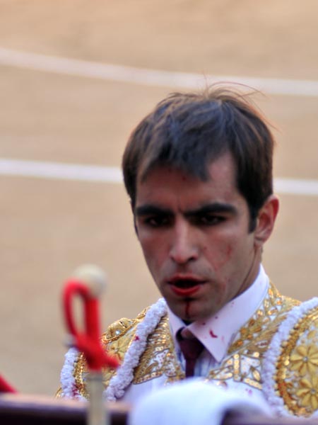 El corte en el ment�n