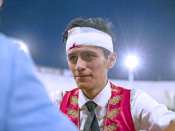 Sufri� corte en la frente