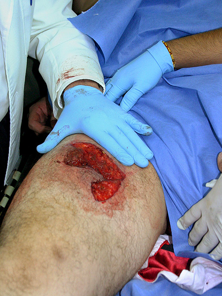 Antes de ir al hospital