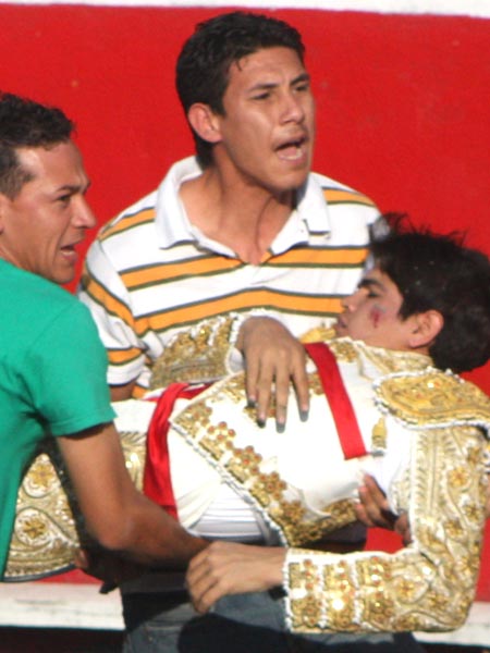 Fractura del p�mulo