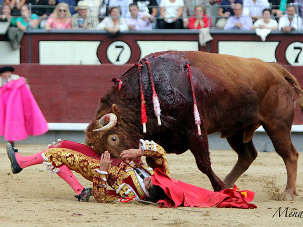 Posible fractura del tobillo