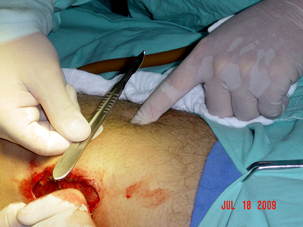 Explorando una de las trayectorias