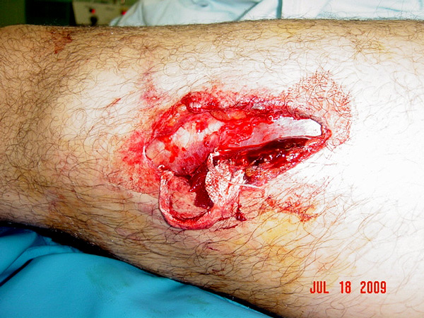 Aspecto de la cornada