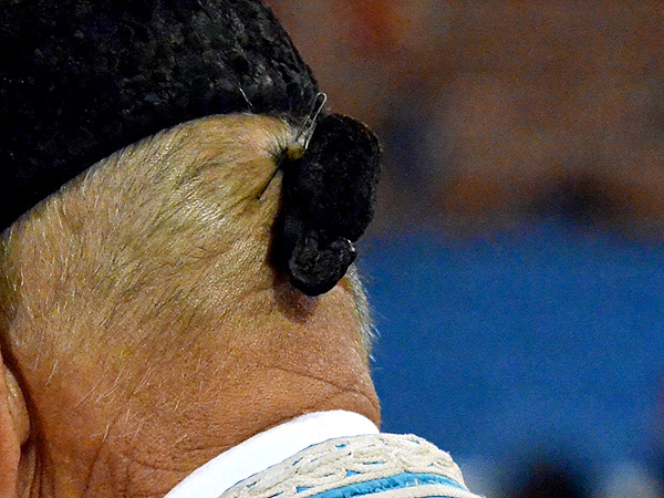 A�adido... sin cabello