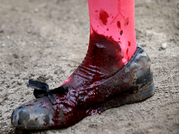 Se cort� con la banderilla